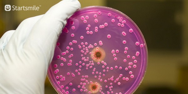 Кандидоз полости рта (кандидозный стоматит), симптомы и способы лечения ...