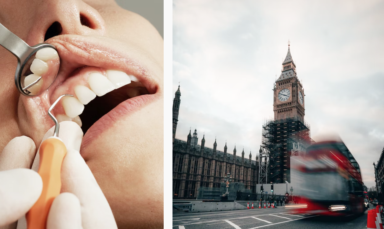 Фото рекламы лечения зубов в автобусах Великобритании.