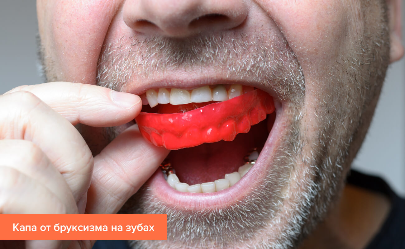 Скрипели зубами по ночам Скрипели зубами по ночам