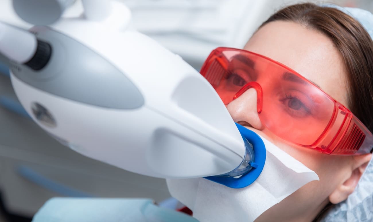 Фото пациентки во время процедуры профессионального отбеливания зубов
