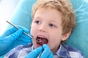 Удаление молочных зубов у детей происходит все чаще