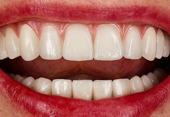 Лечение зубов немецкая клиника thumbnail