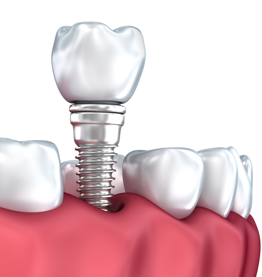 Сколько стоит лечение клиновидный дефект зуба thumbnail