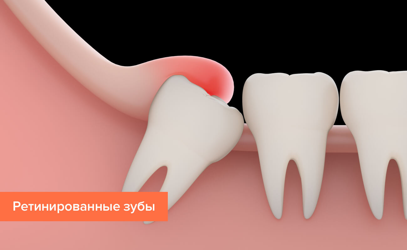 Болезни и лечение зубов человека thumbnail