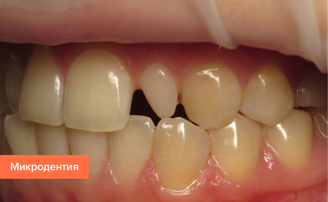 Какие болезни могут быть от зубов thumbnail
