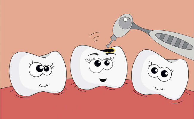 Лечение жевательных зубов у детей thumbnail
