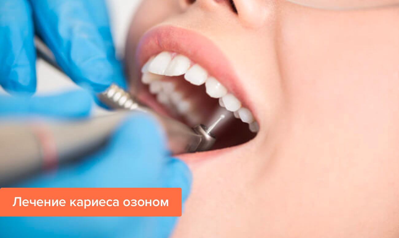 Лечение зуба без сверления thumbnail