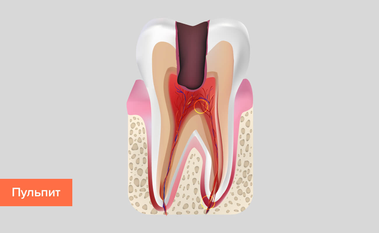 Зубы человека болезни зубов и их лечение thumbnail
