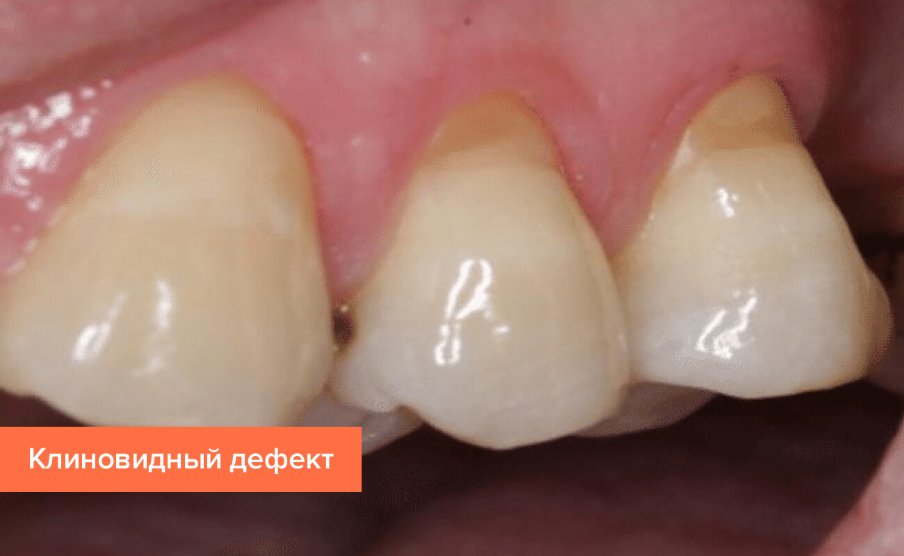 Лечение пациентов с заболеванием зубов thumbnail