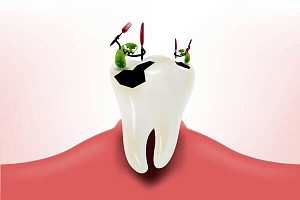 Обезболивание зуба детям для лечения thumbnail