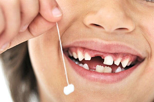 Анестетики при лечении зубов у детей thumbnail