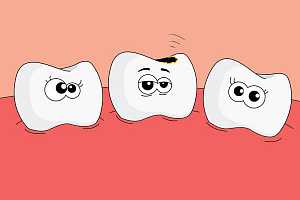 Какое обезболивание детям при лечении зубов thumbnail