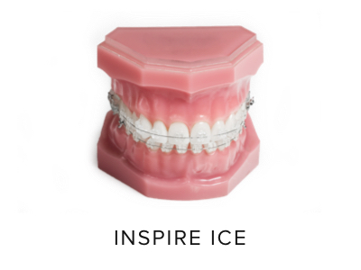Брекеты Inspire Ice — ледяное вдохновение