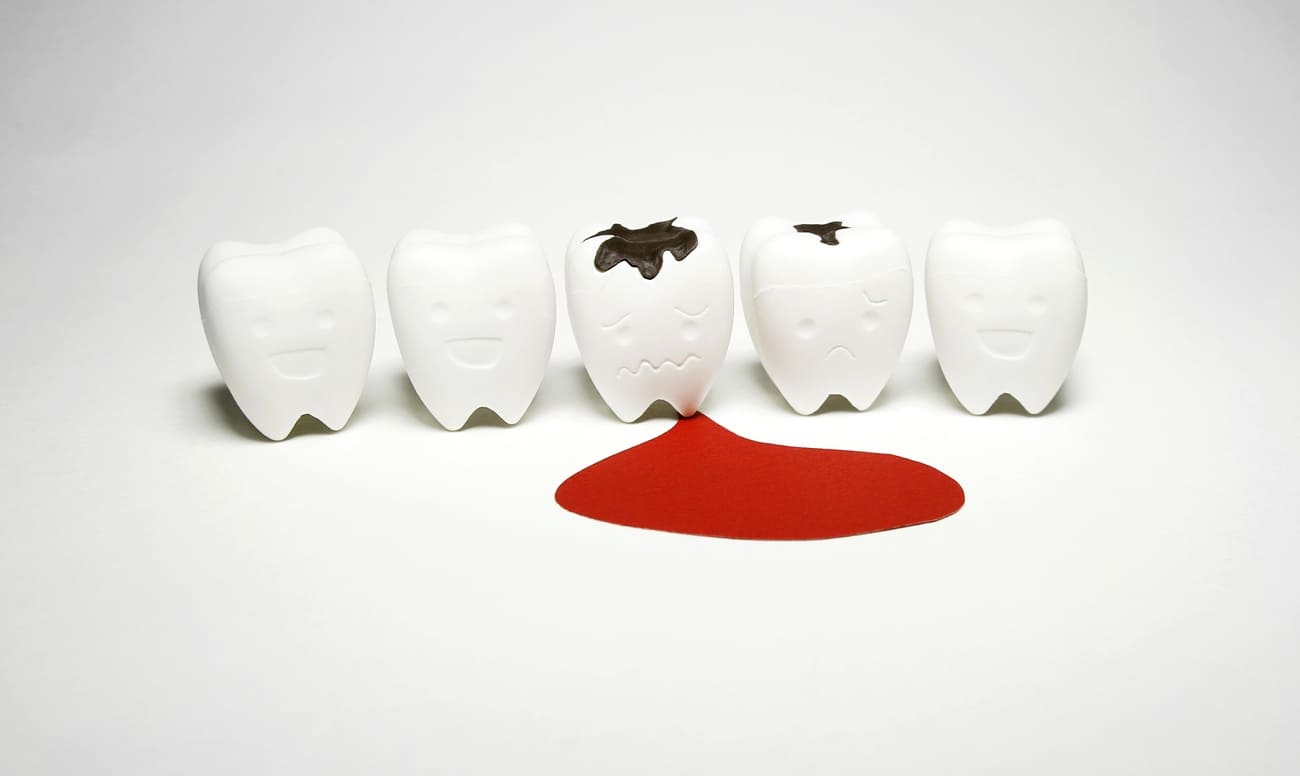 Кровоточивость десен — причины и последствия в статье экспертного ...