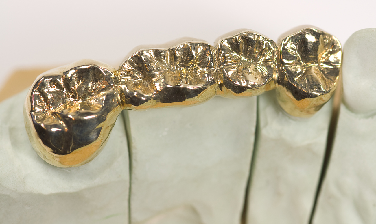 Золотые коронки Томск Кордон 2-я круглосуточная стоматология томск набережная реки
