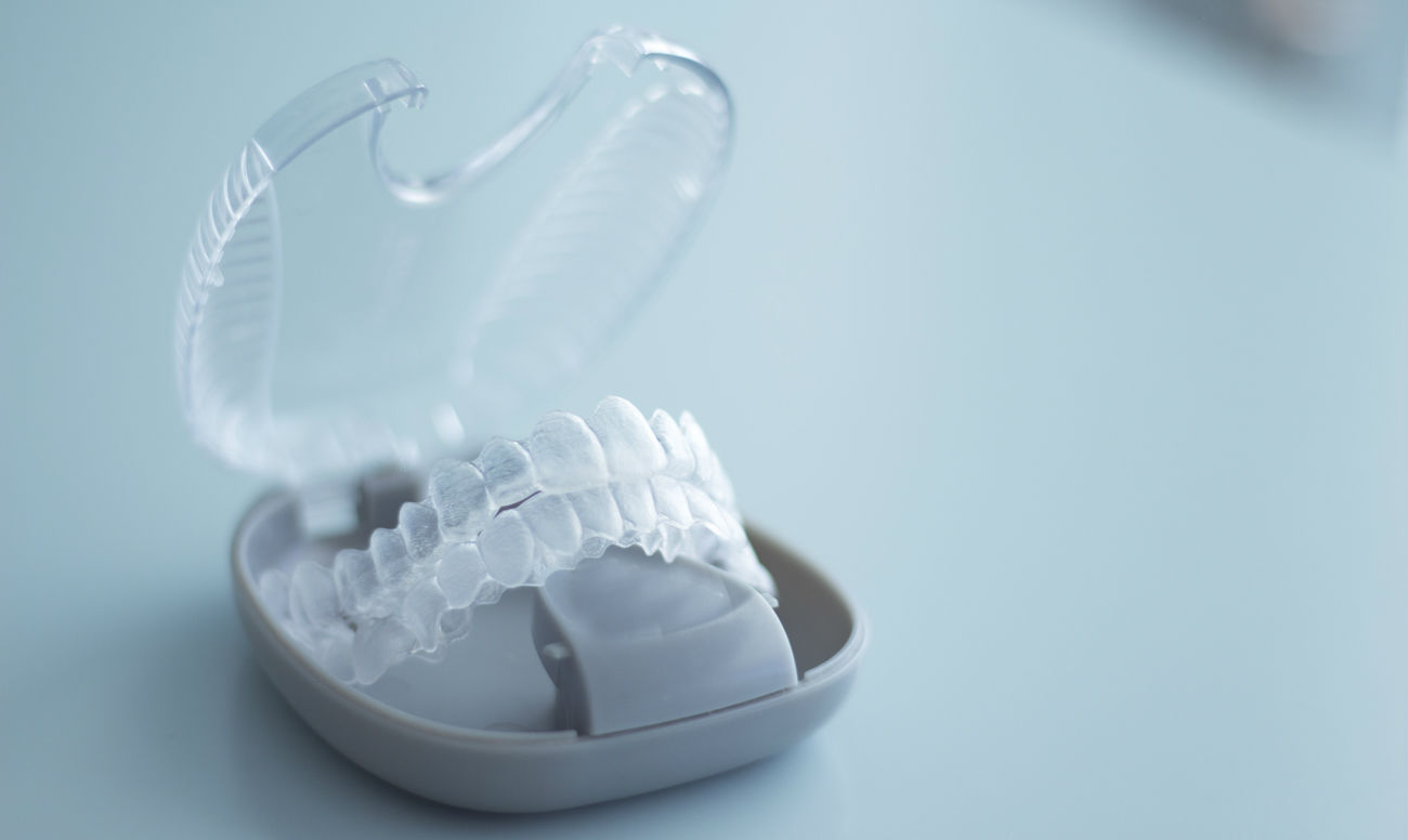 Ретейнеры после брекетов – фото, цена, сколько носить на Startsmile.ru