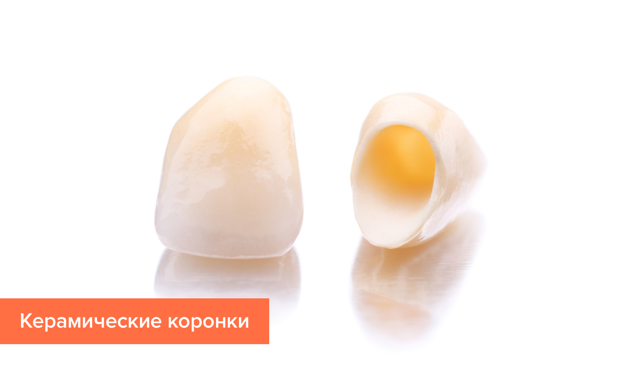 Коронки на зубы из керамики Фото коронок из керамики