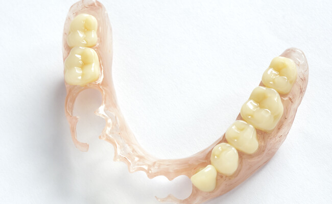Фото бюгельного зубного протеза для детей