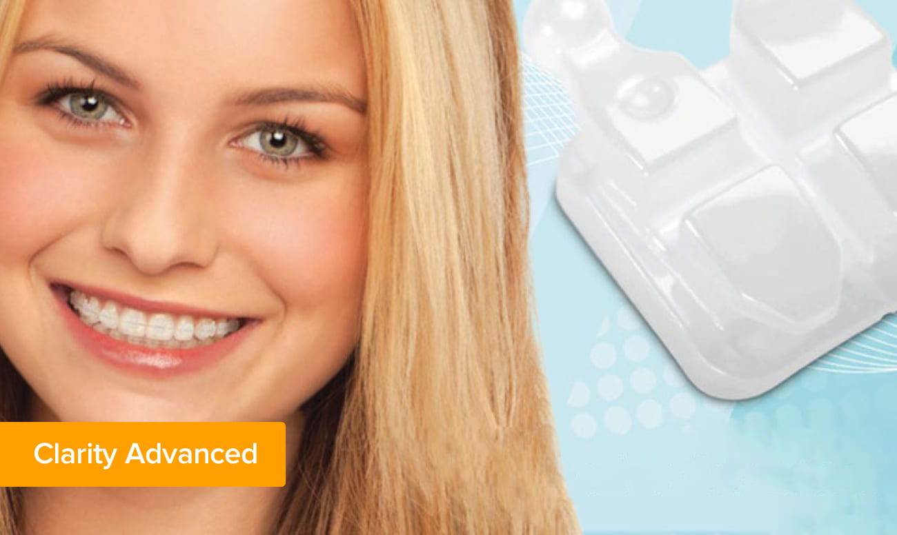 Брекеты Clarity Advanced Фото брекетов Clarity Advanced