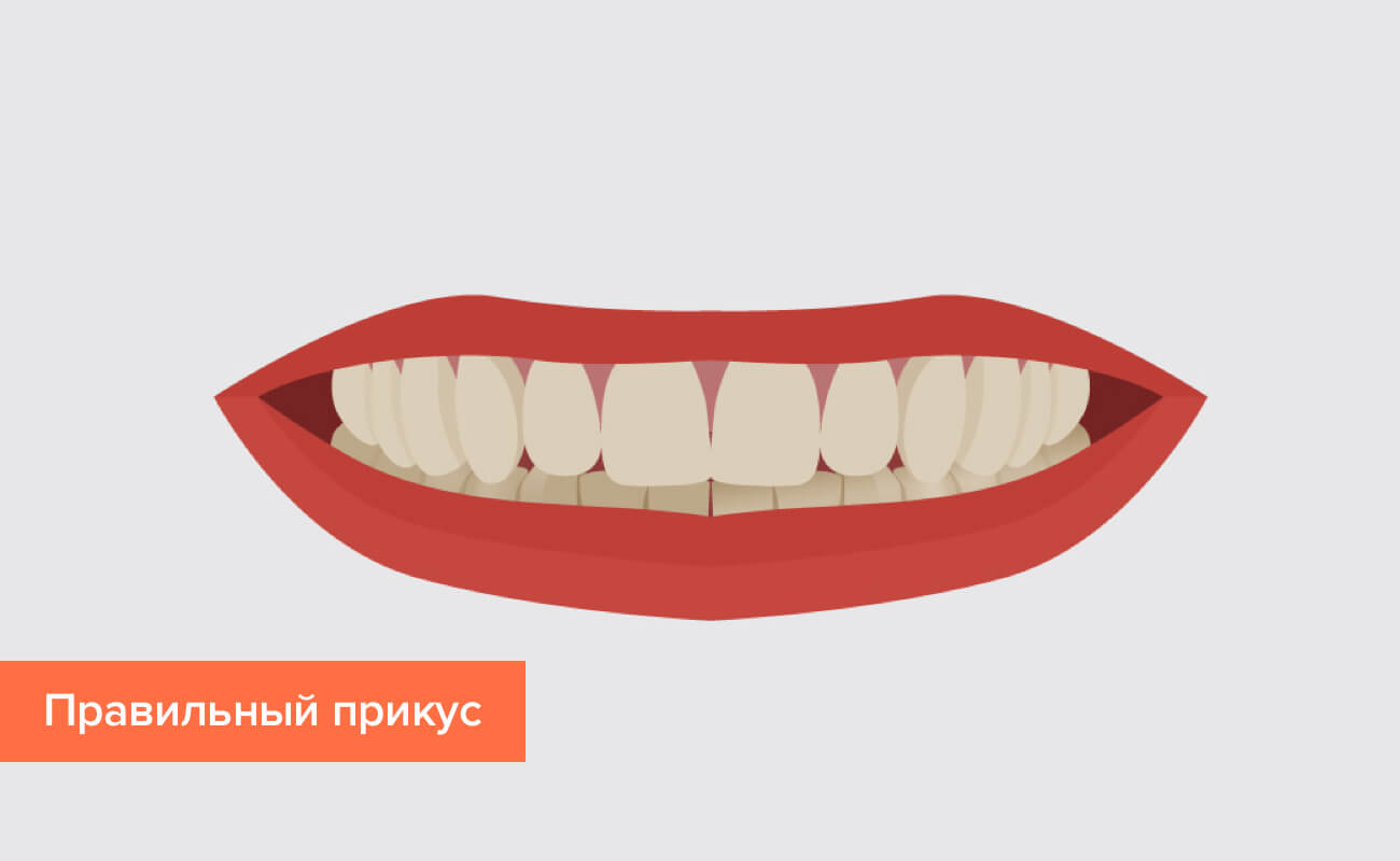 Правильный прикус в картинках Правильный прикус в картинках