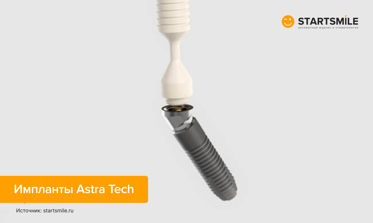 Фото шведского импланта Astra Tech.