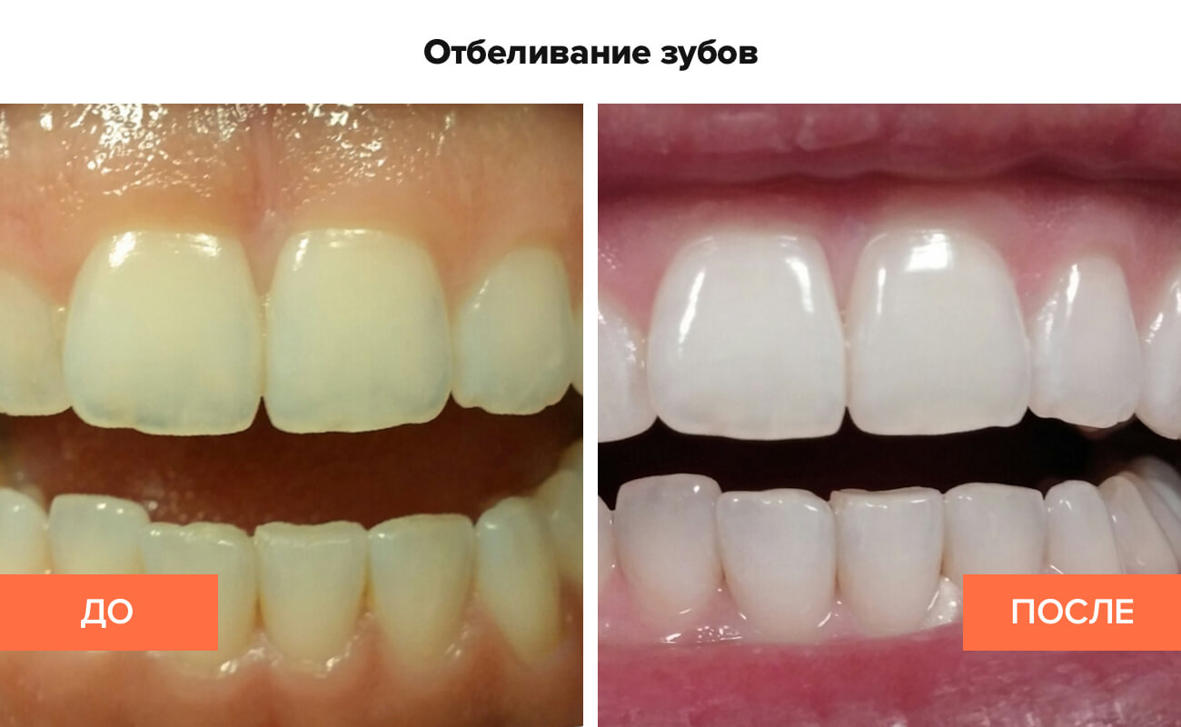 otbelivanie.jpg otbelivanie.jpg