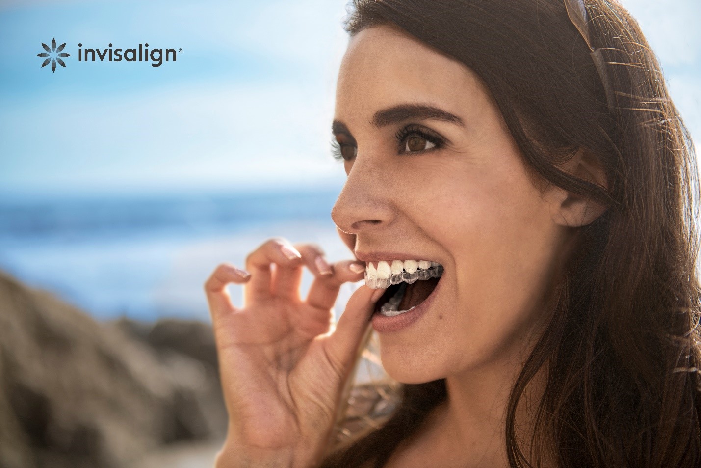 Фото Invisalign® (США)