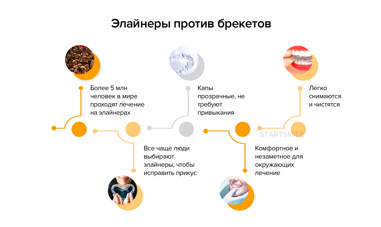 Инфографика о том, почему многие пациенты выбирают элайнеры, а не брекеты