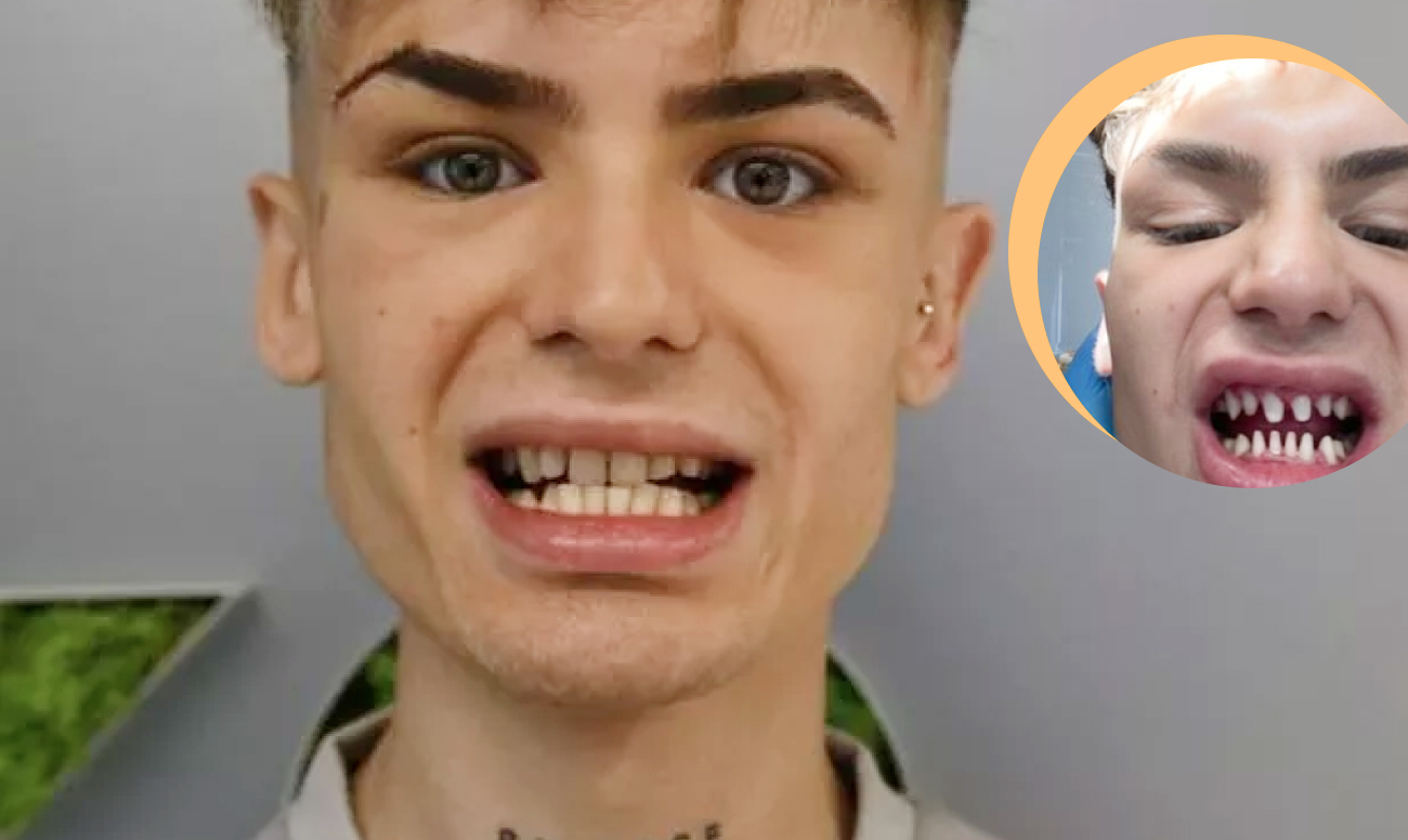 Очередной провал «турецких улыбок»