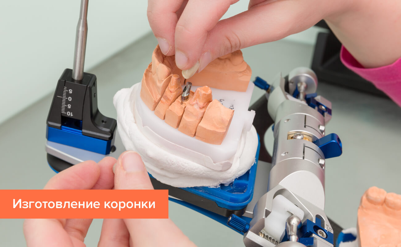 Фото процесса изготовления коронки