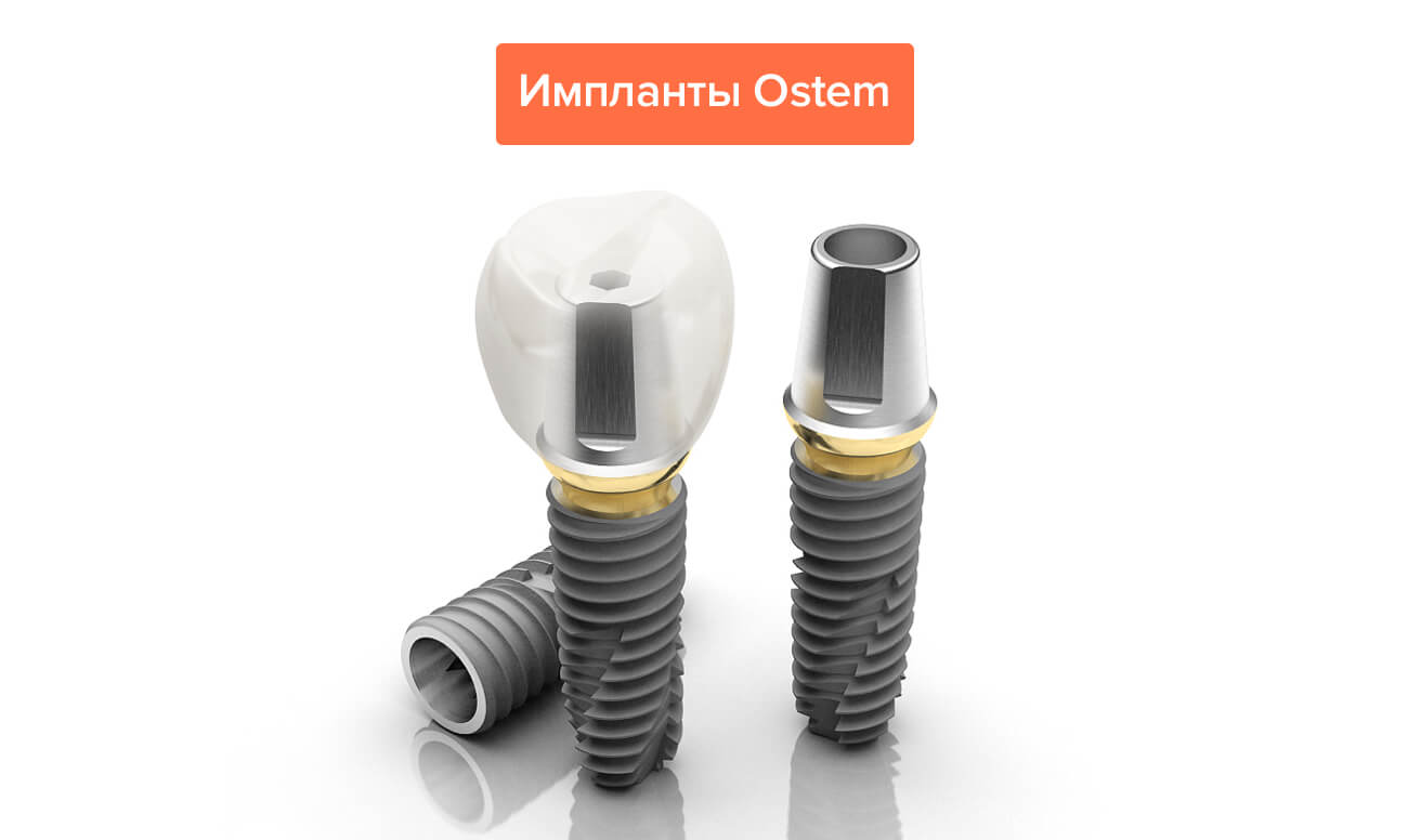 Импланты Osstem Томск Баргузинская дентальная стоматология томск