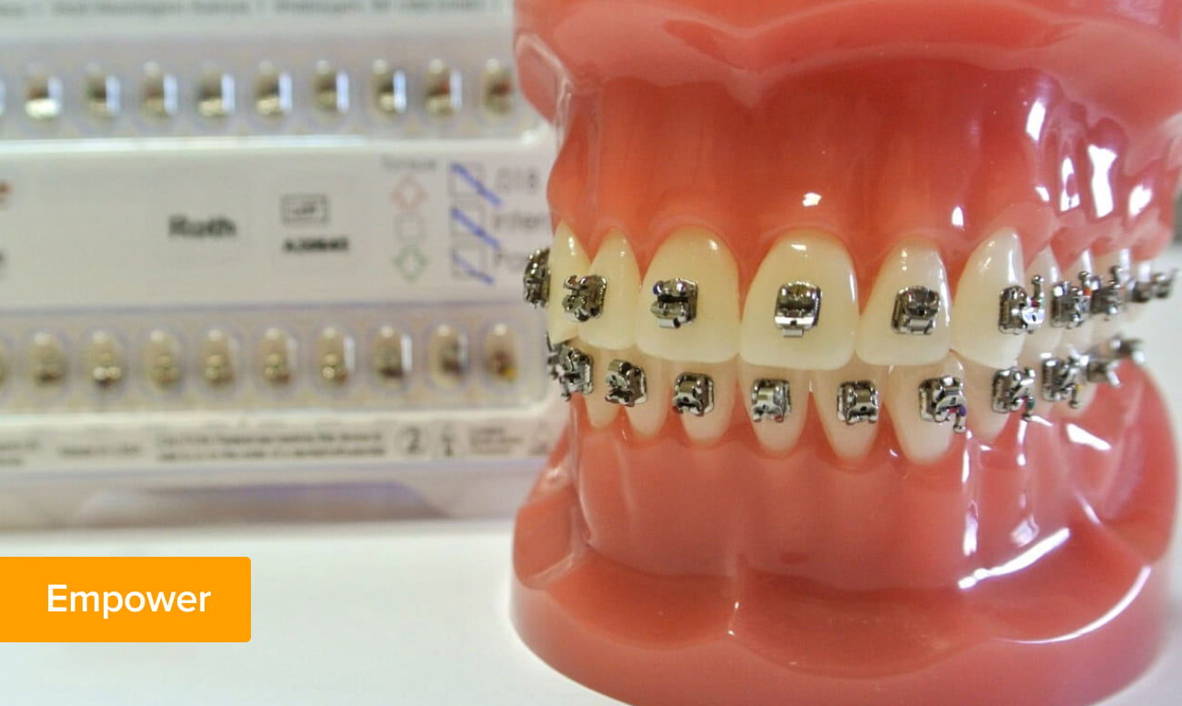 Металлические брекеты American Orthodontics Empower Фото металлических брекетов American Orthodontics Empower