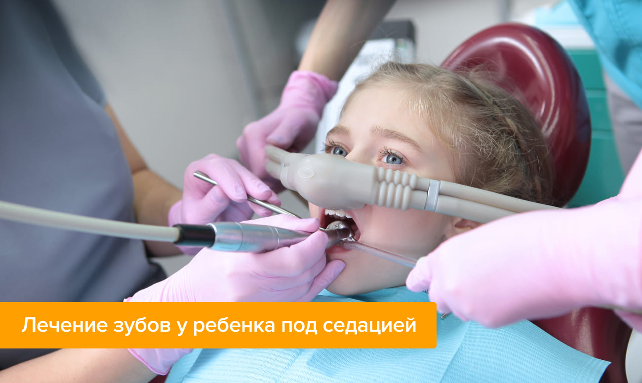 Фото лечения зубов у ребенка под седацией