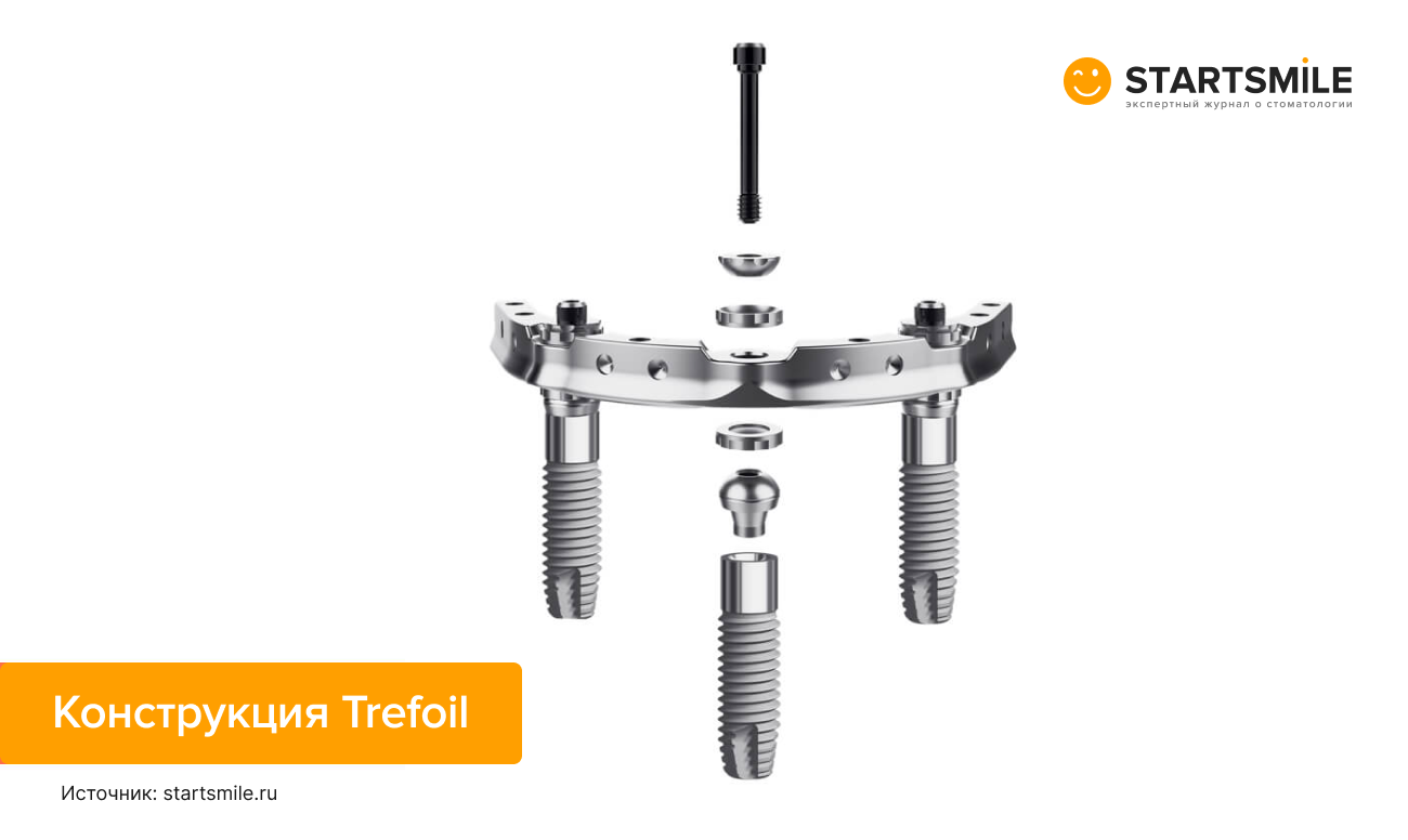 Конструкция Trefoil Фото конструкции Trefoil