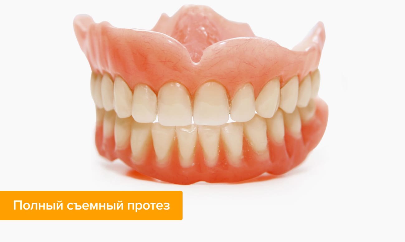 Протезирование зубов на имплантах что такое при полном отсутствии. Смотреть фото Протезирование зубов на имплантах что такое при полном отсутствии. Смотреть картинку Протезирование зубов на имплантах что такое при полном отсутствии. Картинка про Протезирование зубов на имплантах что такое при полном отсутствии. Фото Протезирование зубов на имплантах что такое при полном отсутствии
