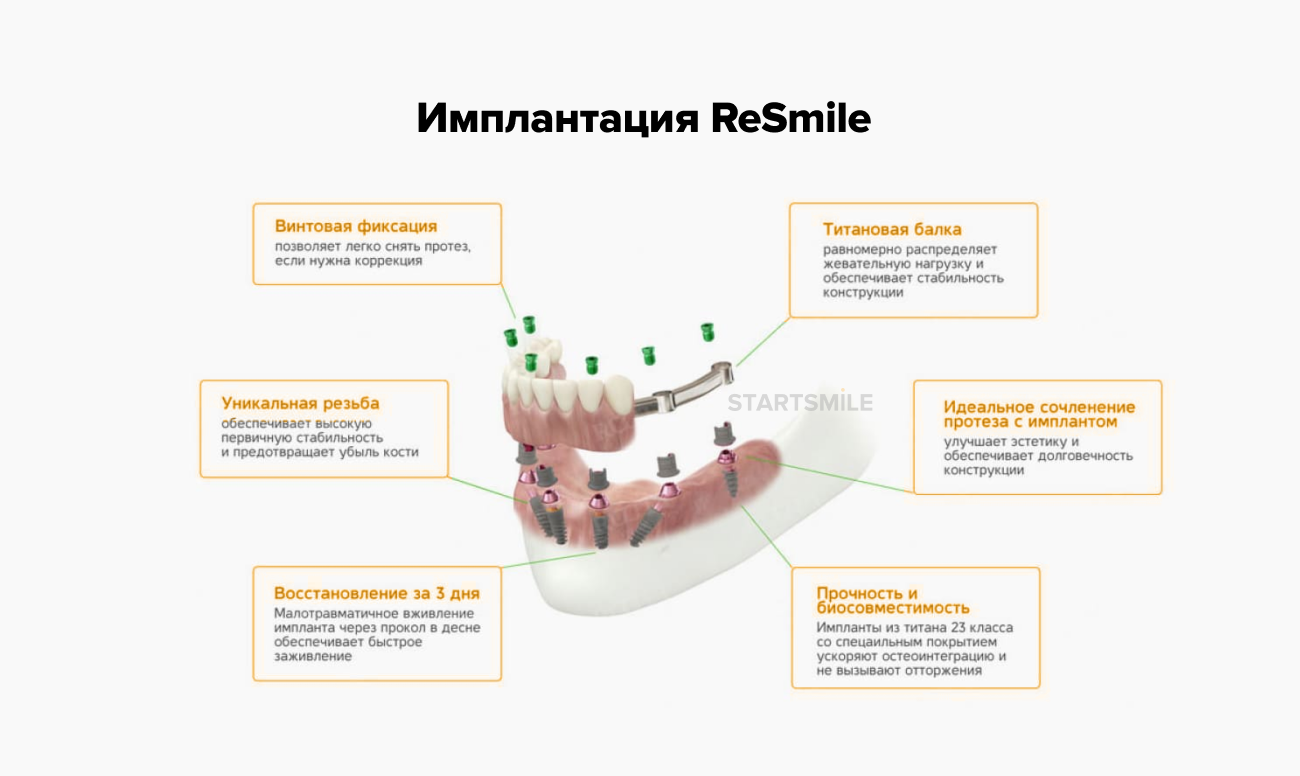 Имплантация ReSmile в картинках