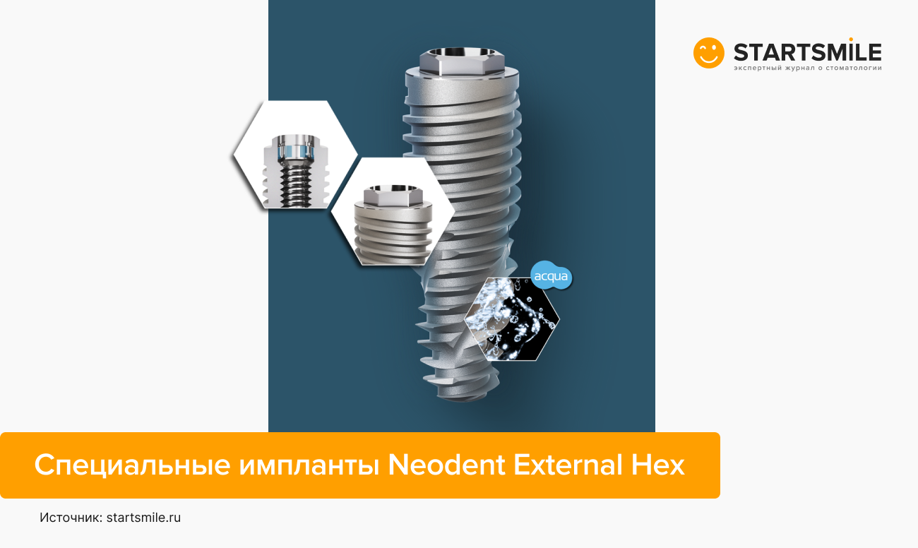 Специальные импланты Neodent External Hex в картинках