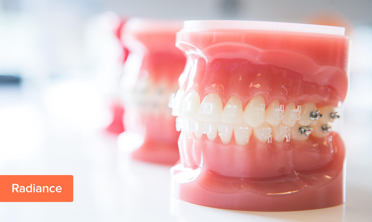Фото сапфировых брекетов Radiance от American Orthodontics