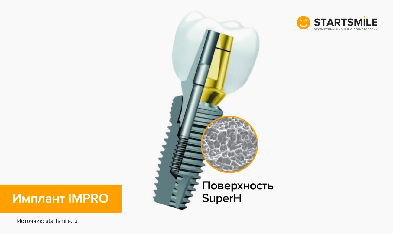 Фото импланта Impro.