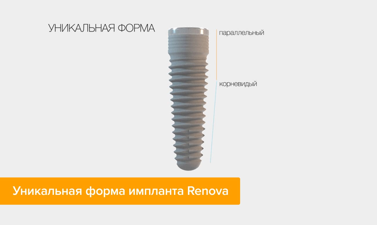 Гибридная форма имплантатов Renova Фото гибридной формы имплантатов Renova