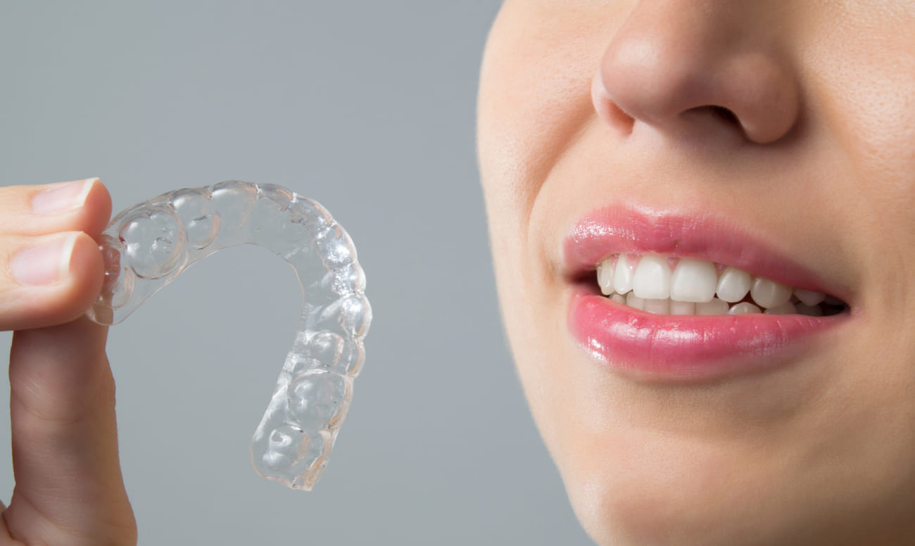 Фото элайнеров Invisalign