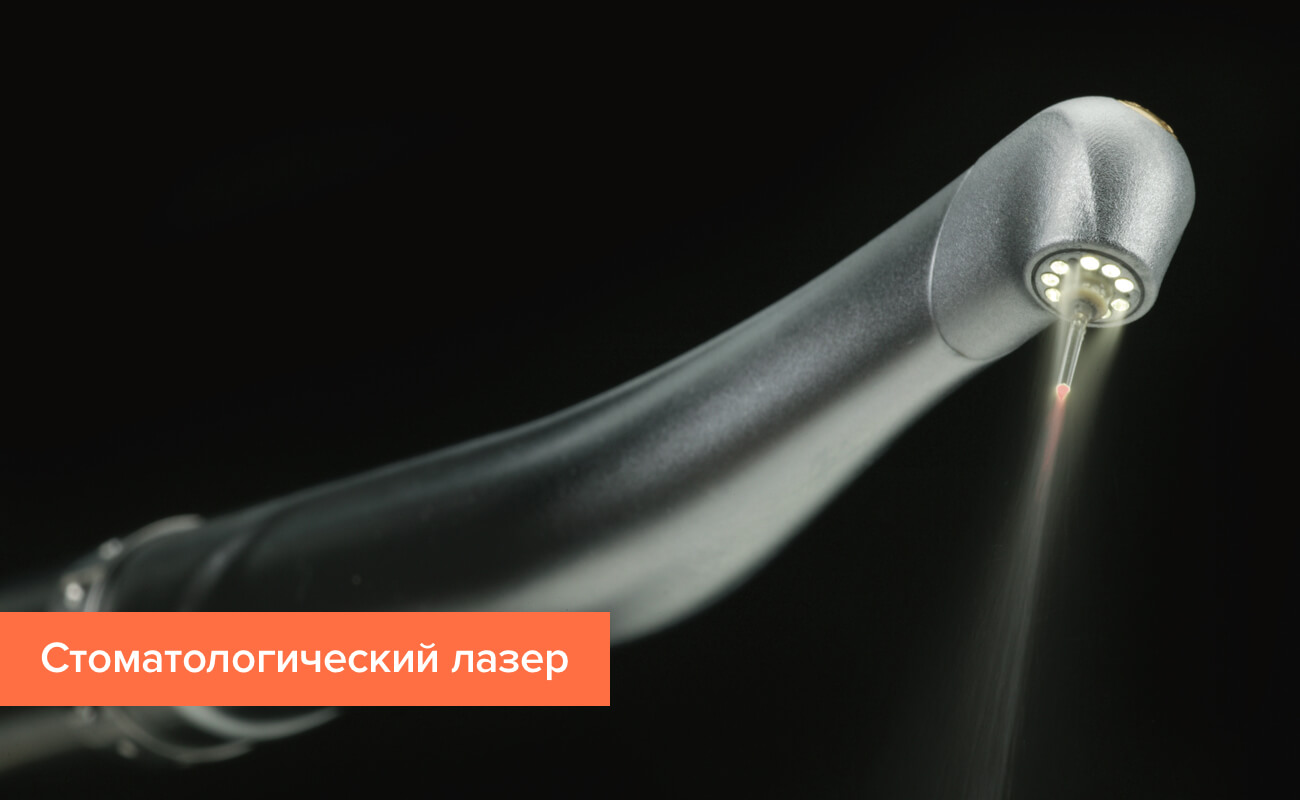 Фото стоматологического лазера