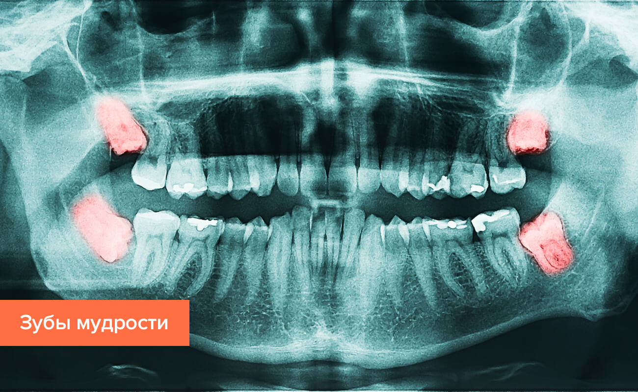 Фото Челюсти С Зубами По Номерам