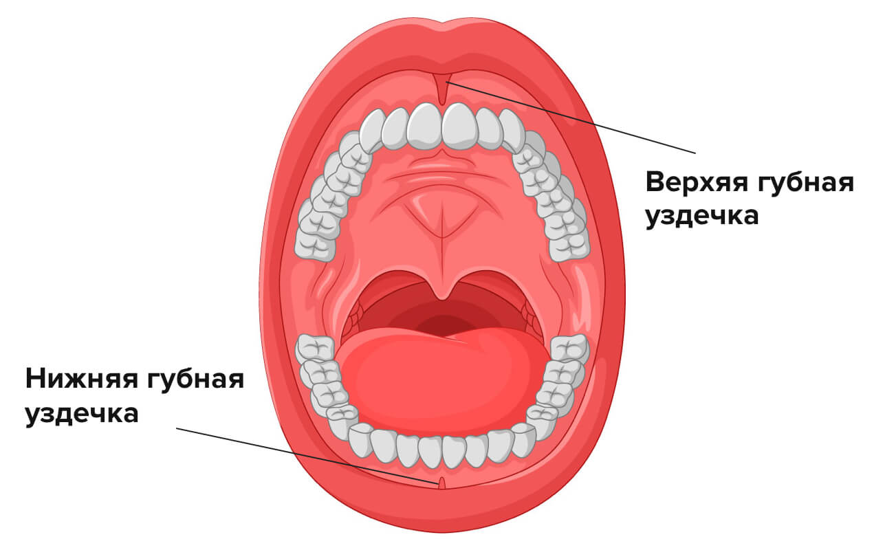Уздечки верхней и нижней губы в картинках