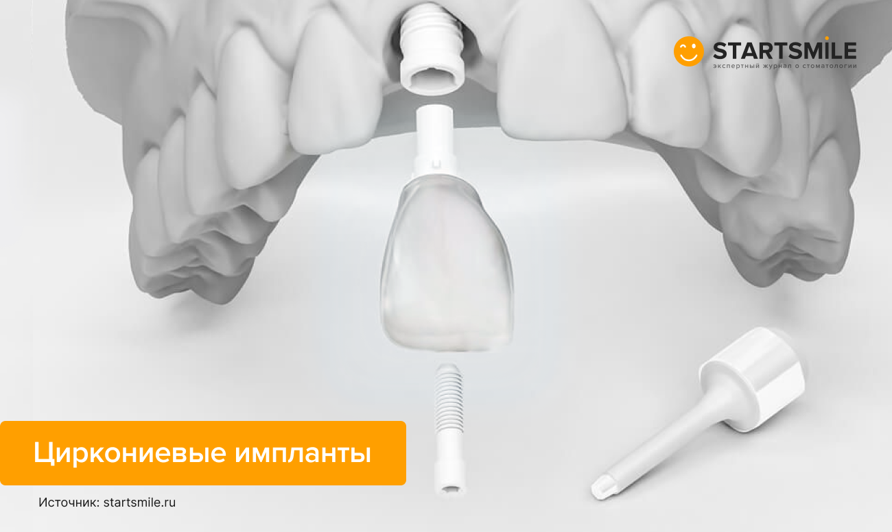Циркониевые имплантаты Циркониевые имплантаты в картинках.