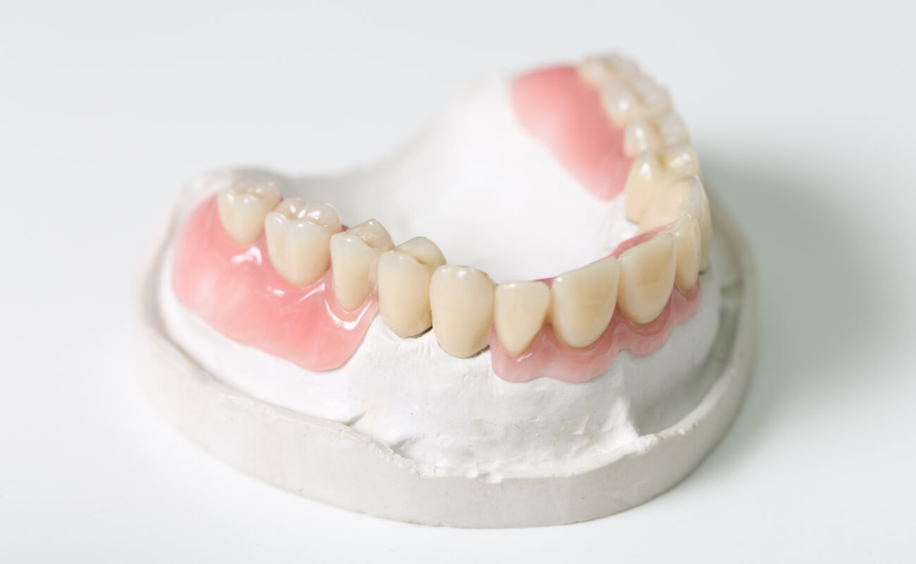 Фото пластмассового зубного протеза