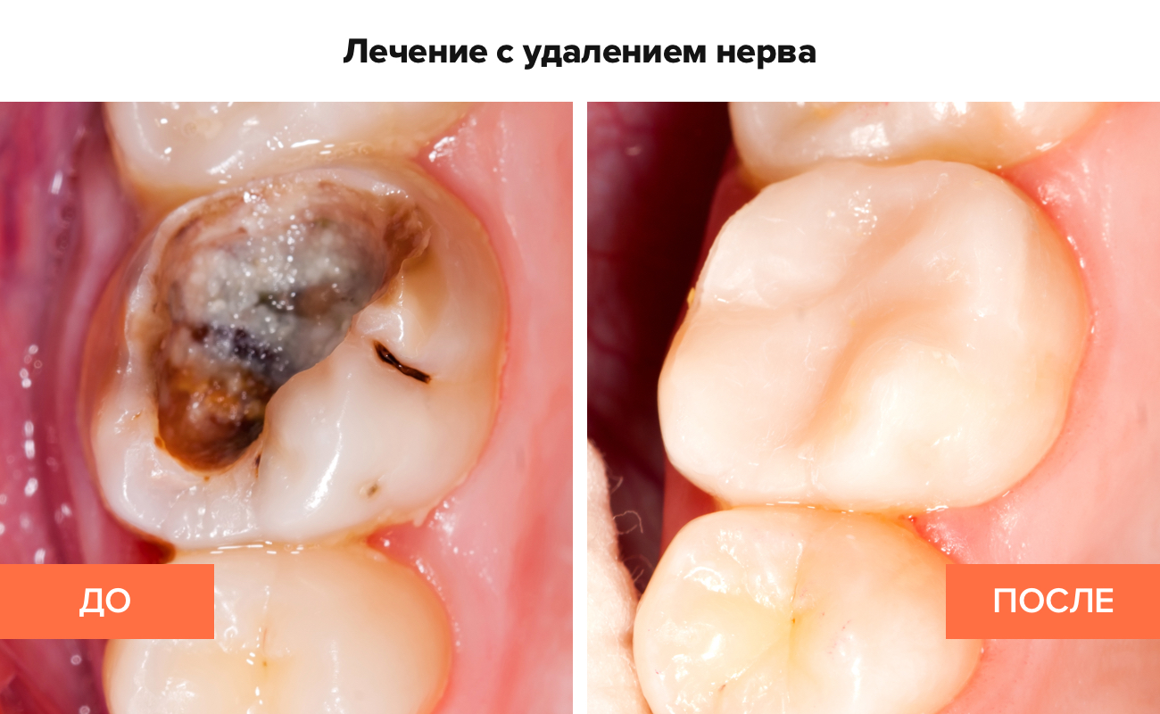 Масло усьма для ресниц отзывы фото до и после Масло усьма для ресниц отзывы фото до и после