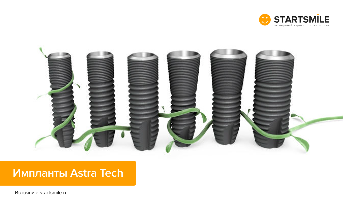 Astra Tech импланты — отзывы, установка, отличия от других систем ...