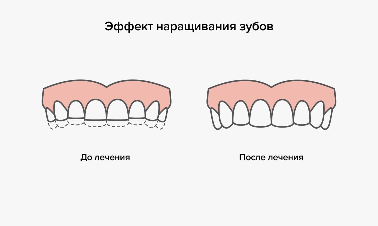 do i posle naraschivaniya zubov 1