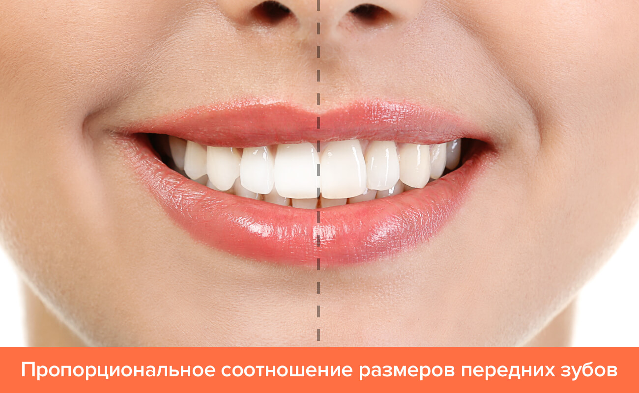 Фото пропорционального соотношения размеров передних зубов